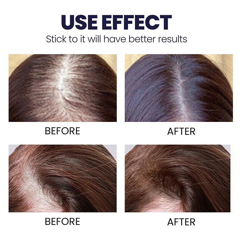 FEG HAIR GROWTH SPRAY | VISIBLE GROWTH IN 15 DAYS